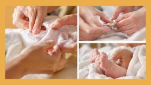 soins du cordon ombilical